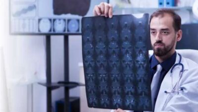 Clínicas Neurológicas en Puente Piedra