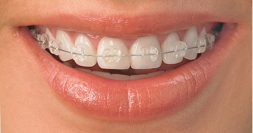 Clínica dental "Los Fresnos"