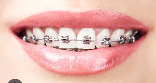 C. Dental Esperanza