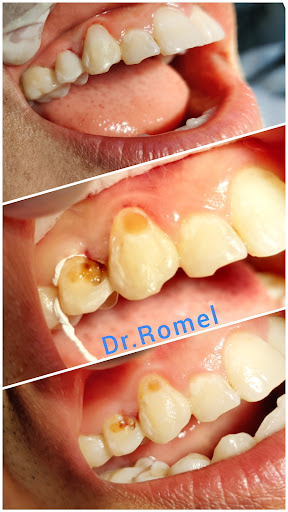Your Dentist - Estética Dental 926 291 407. DR.ROMEL