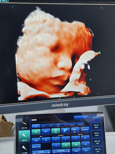 FEM MEDICAL - CHOSICA| Ginecología y Ecografias 6D