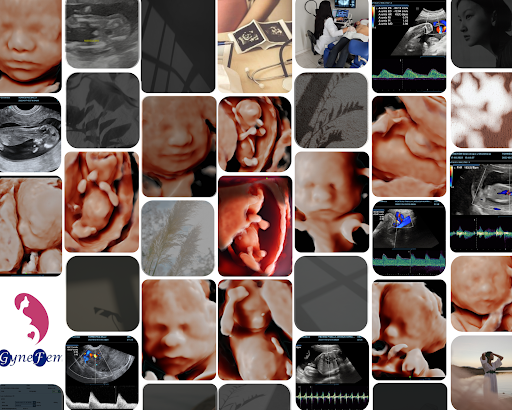 Gynefem Ginecología y Obstetricia