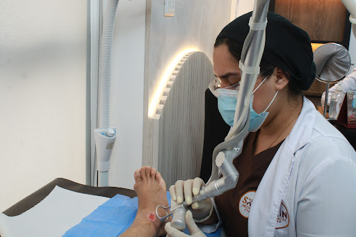 Skin Medical Centro Laser, Pie diabético, Quemaduras, Heridas, Cicatrices, Queloides, Escaras y Úlceras