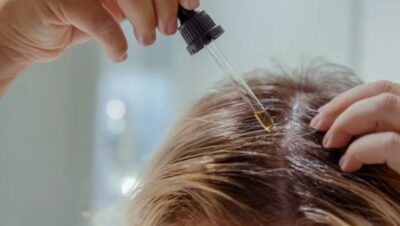 Clínicas de Caída del Cabello en Cieneguilla
