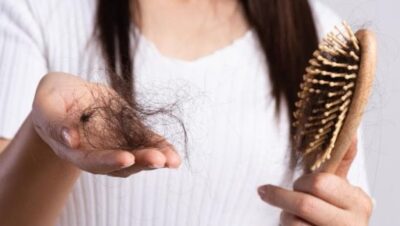 Clínicas de Caída del Cabello en Comas