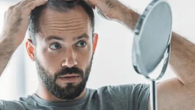 Clínicas de Caída del Cabello en El Agustino