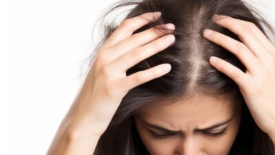 Clínicas de Caída del Cabello en Independencia