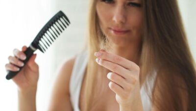 Clínicas de Caída del Cabello en Lince