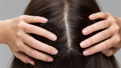 Clínicas de Caída del Cabello en Miraflores