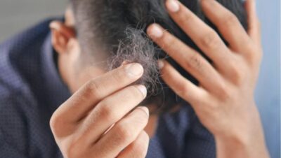 Clínicas de Caída del Cabello en Punta Negra