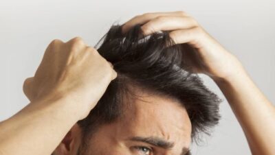 Clínicas de Caída del Cabello en San Luis