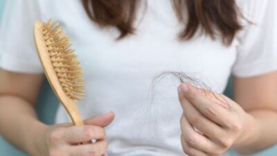 Clínicas de Caída del Cabello en Santa Rosa