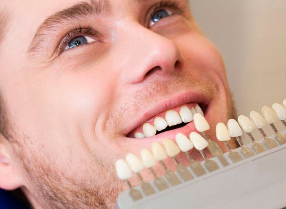 Clínicas de Carillas Dentales en Rímac