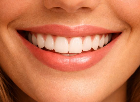 Clínicas de Diseño de Sonrisa en Los Olivos