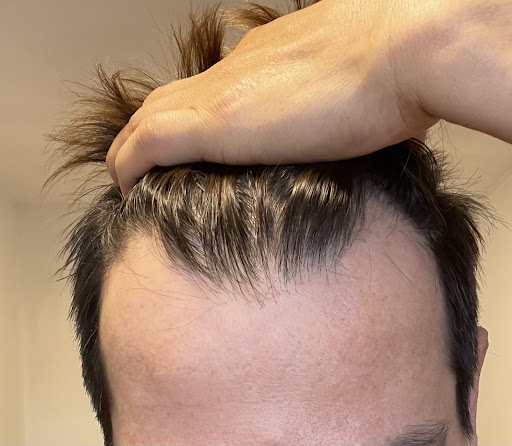 Procabell Centro Capilar Perú