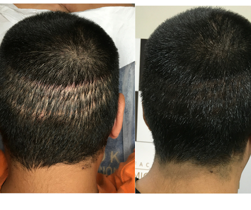 Facelook Esthetic Scalp Clinic