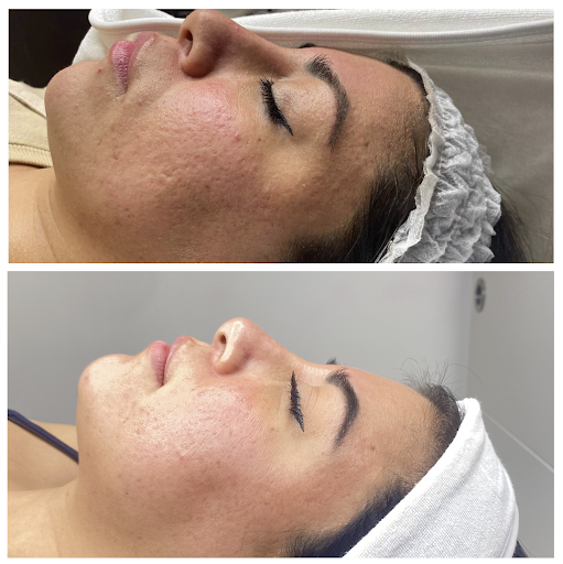 Imebelle Lima Clínica Estética y Depilación Láser