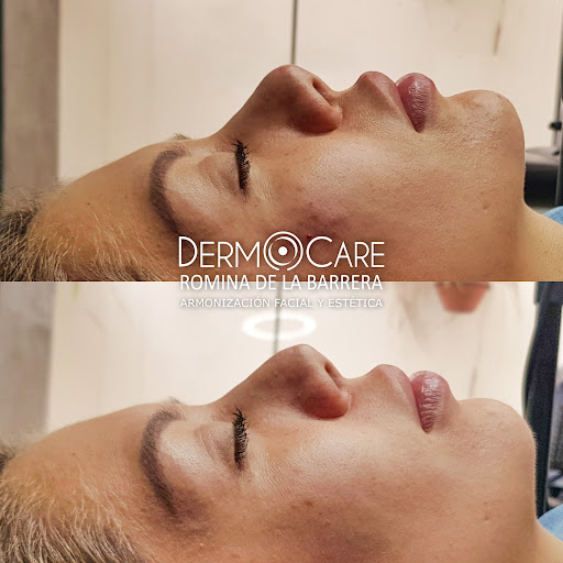 DermoCare Estética y Armonización Facial