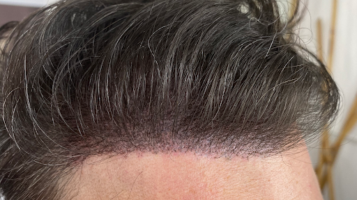 Facelook Esthetic Scalp Clinic