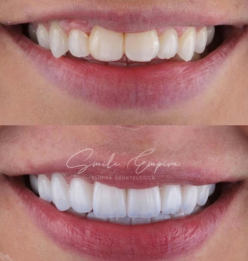 Clínica Especializada Smile Empire