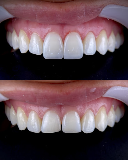 Dra. Diana Zuñiga | Ortodoncia Invisible e Invisalign en Barranco (cerca de Miraflores)