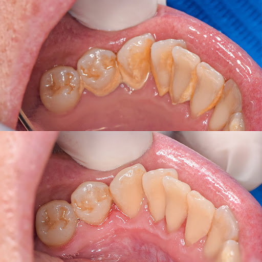 Clínica Dental Odonto Services - Especialistas en Ortodoncia y Carillas