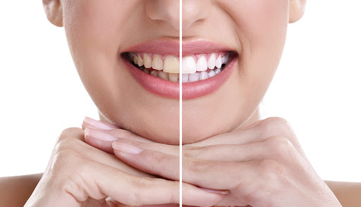 DENTUM - Clínica Dental, Brackets, Ortodoncia, Odontólogos, INVISALIGN, Dentistas, Curaciones Dentales en Niños, Jesús María