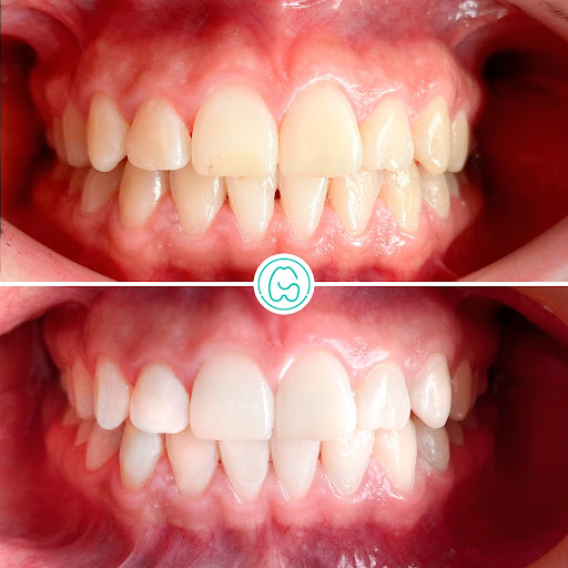 Sonrisa Segura La Molina