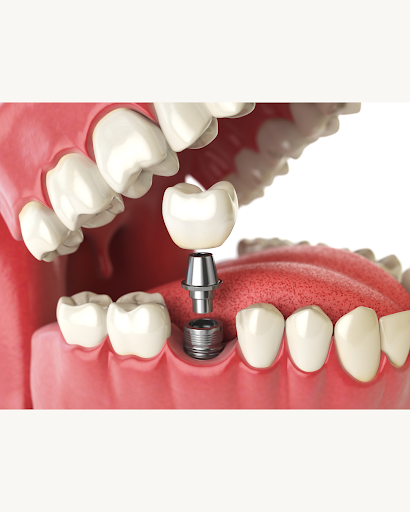 Centro Odontologico Lignum