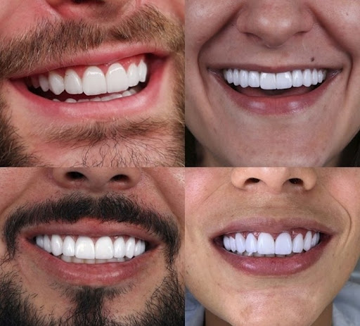 🔶️Clínica de las Sonrisas - Implantes dentales, Brackets y Diseño de Sonrisa en Lima Norte