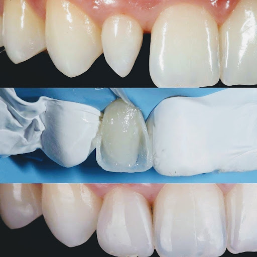 Tu Sonrisa Odontologia Especializada