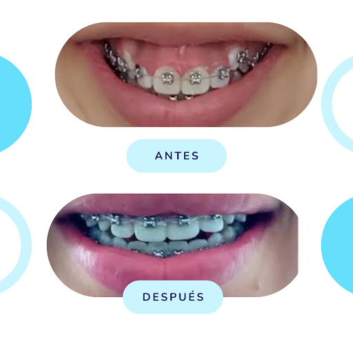 Sonriplan Puente Piedra