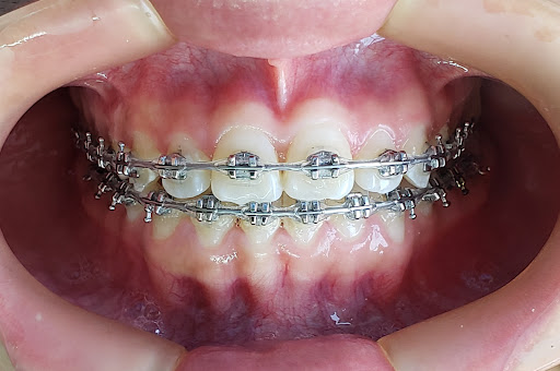 Clinica Dental Santa Anita