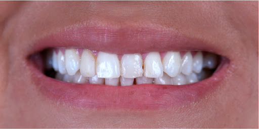 IDent Centro Dental | Surco