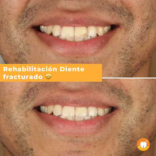 Impacto Dental Jesús María | Diseño de Sonrisa | Ortodoncia | Implantes | Alineadores
