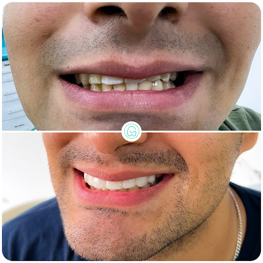 Sonrisa Segura Surco