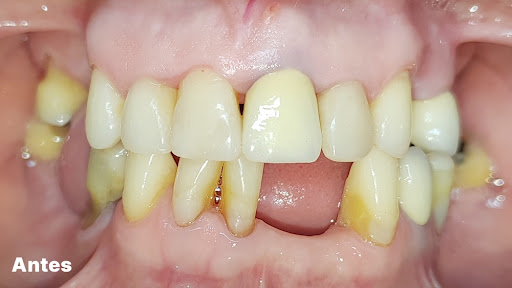 Solución Dental | Especialistas en Ortodoncia