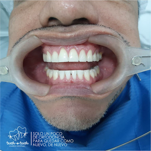 TEETH&TEETH