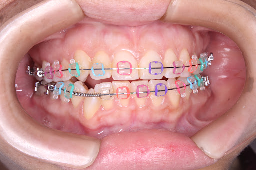 MORESMILING odontólogia integral y estética- sede Pueblo Libre