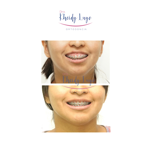 Dentista en San Isidro - Luyo Ortodoncia y Centro de Bienestar