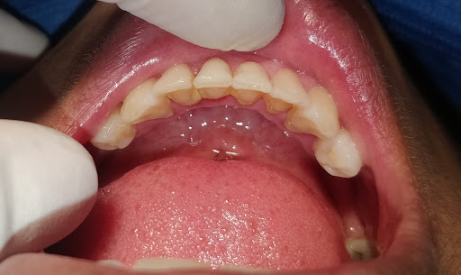 Your Dentist - Estética Dental 926 291 407. DR.ROMEL