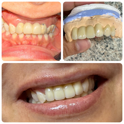 Dra. Ana Romero, Estética Dental