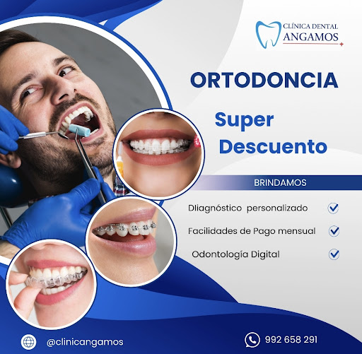 CLINICA DENTAL ANGAMOS