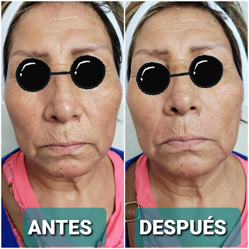 Dra. Rosario Jaime, Dermatologo