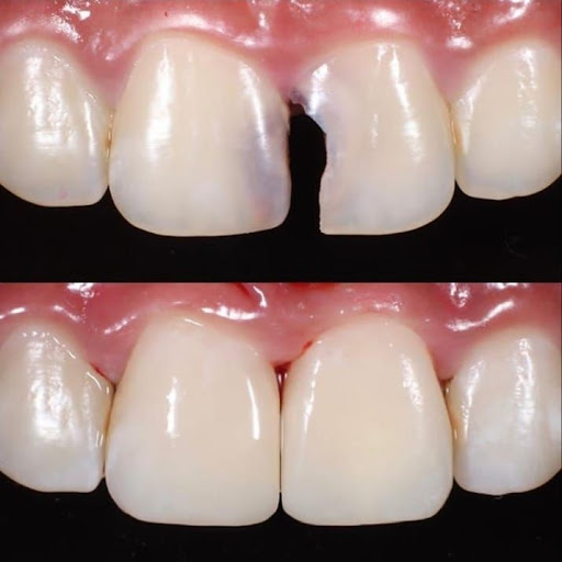 INSPIRIT CLINICA DENTAL - Sede Bolognesi