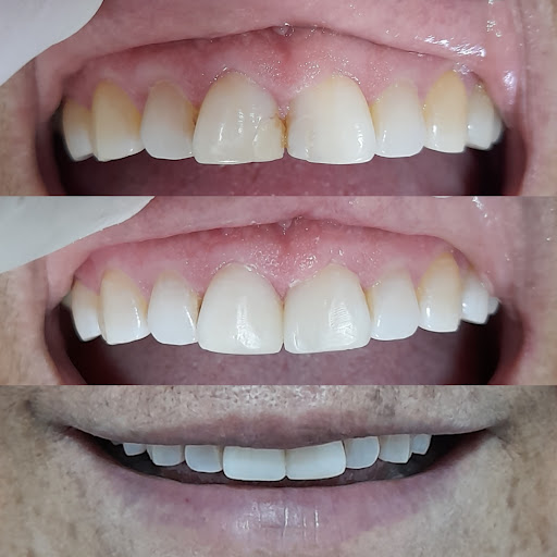 CLINICA DENTAL RENGIDENT