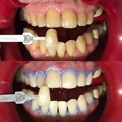 Clínica Dental PROVIDENCE - Odontología Especializada