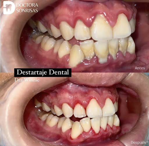 Consultorio Dental “Doctora Sonrisas” 👩🏻‍⚕️🇵🇪 CHOSICA