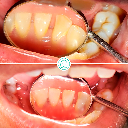 Sonrisa Segura Zarate