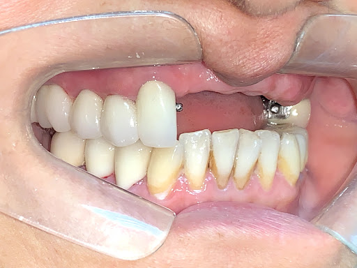 Dentista en Miraflores - Lima -Odontodigital